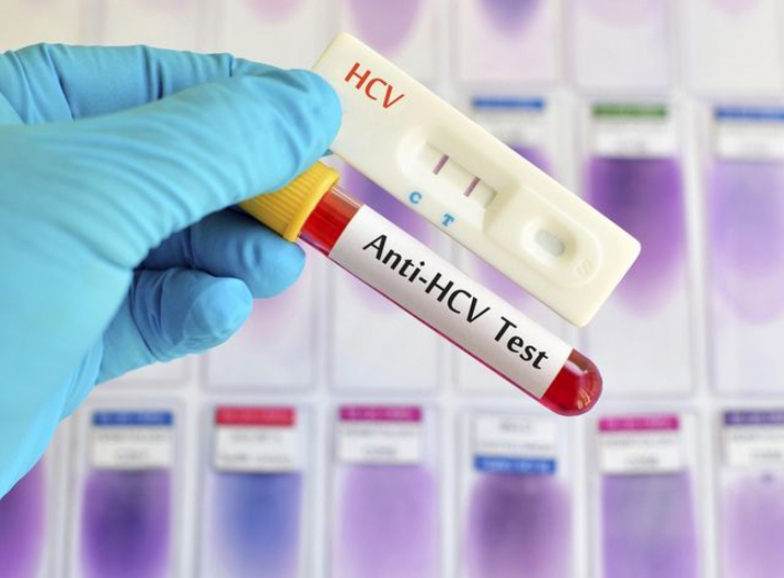 У Сумах відбудеться безкоштовне тестування на вірусний гепатит С фото